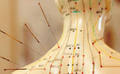 How is the acupuncture popularity?