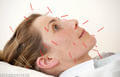 New Study About Problem of Metal Acupuncture Needles