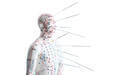 Which situations shouldn't acupuncture?